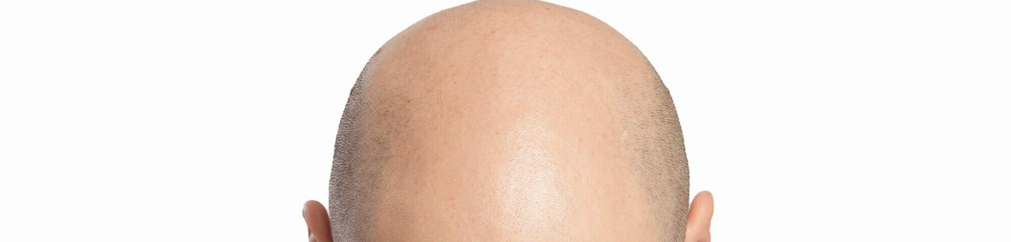 creator cover Username